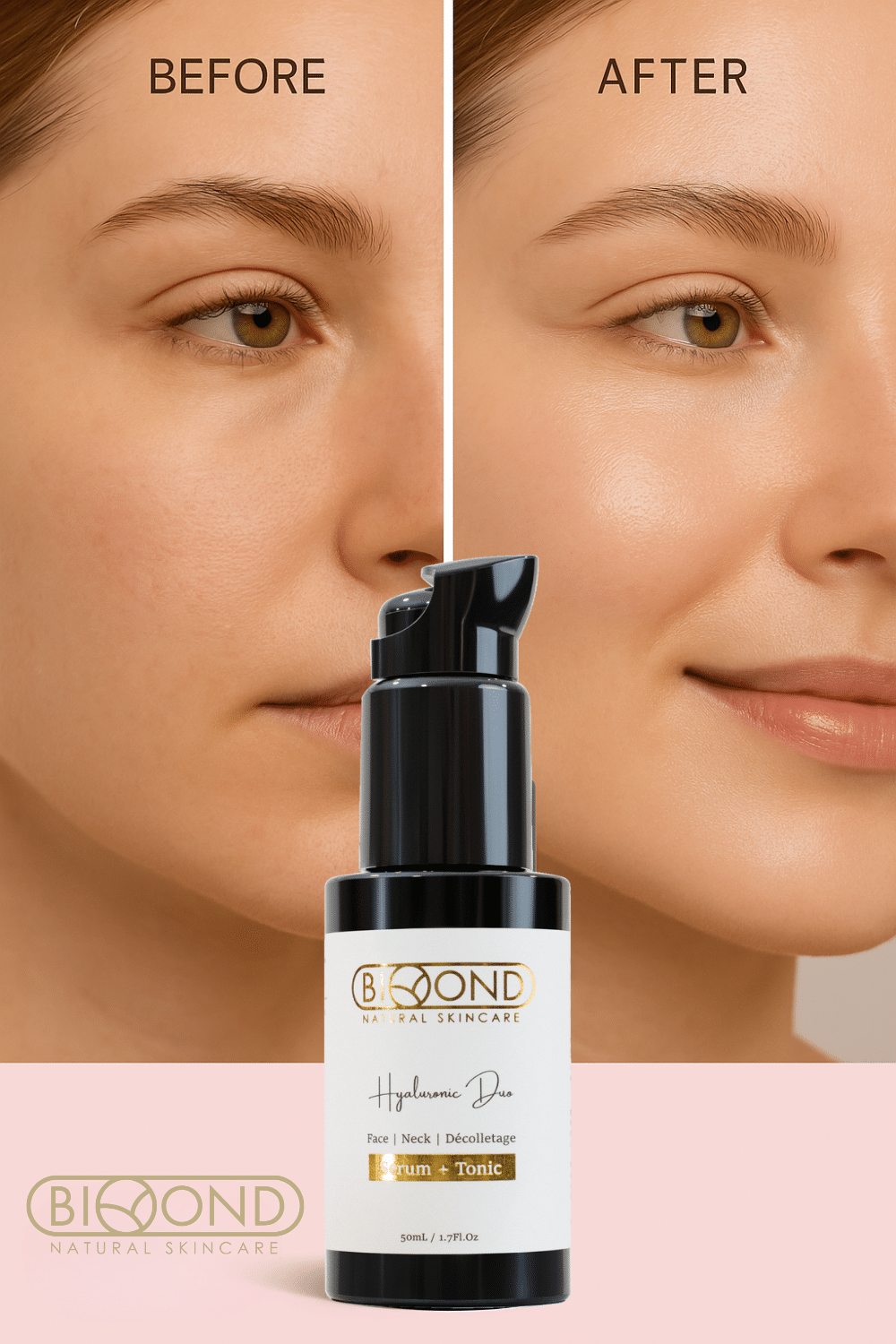 Before and after results using Hyaluronic Duo from BIOYOND natural skincare Canada