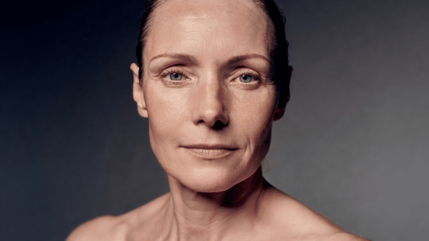 Woman with aged skin After BIOYOND