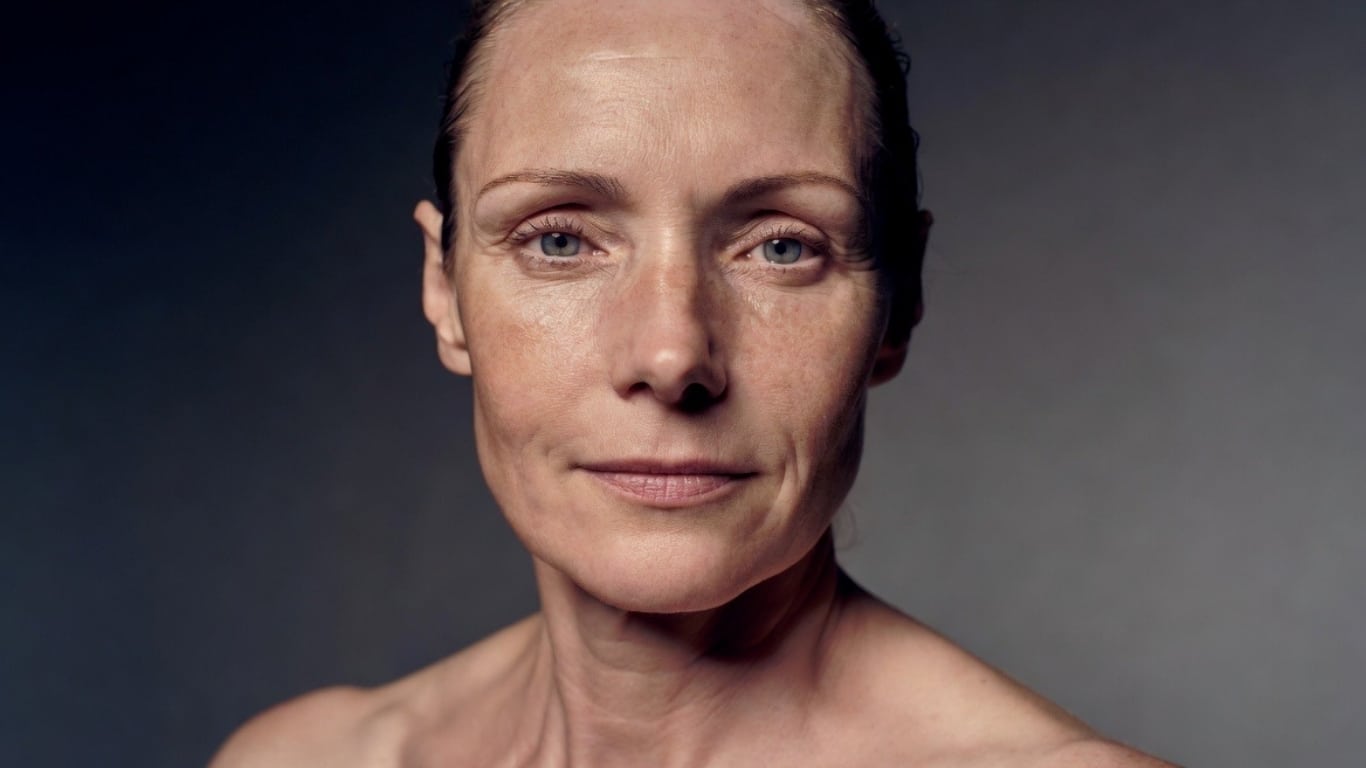 Woman with aged skin BIOYOND
